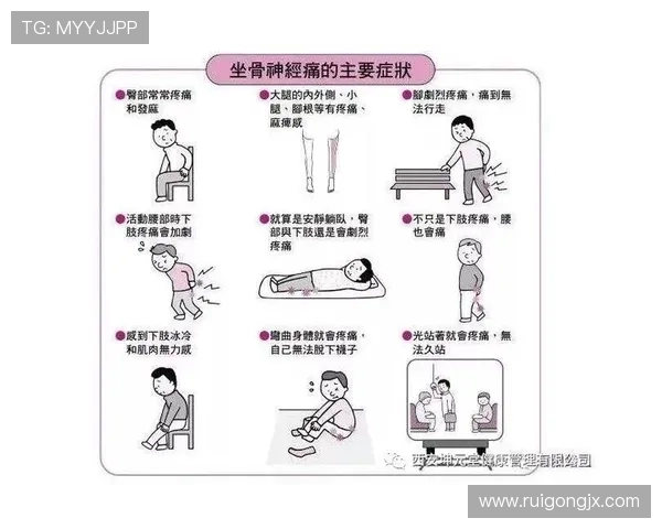 专家解读坐骨神经痛成因及治疗方法大多数患者可避免手术治疗